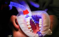 THE SIGNS OF ORAL CANCER!