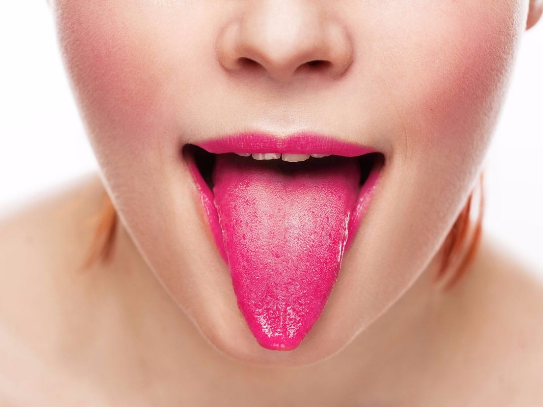 Is the Red Tongue a Symptom of a Disease?