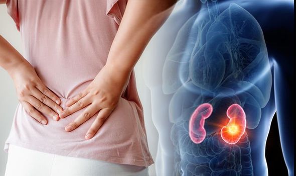 When Back Pain Indicates Kidney Disease?