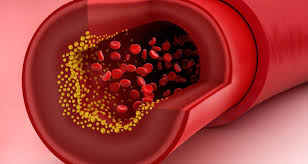 Important Facts About Cholesterol for Adults!