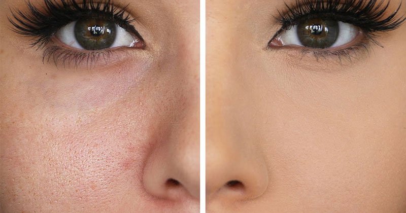 Tips That Make the Pores Look Smaller