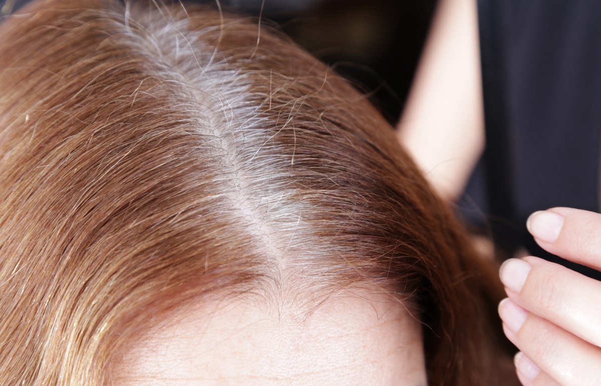 Why You Have Gray Hair Too Quickly