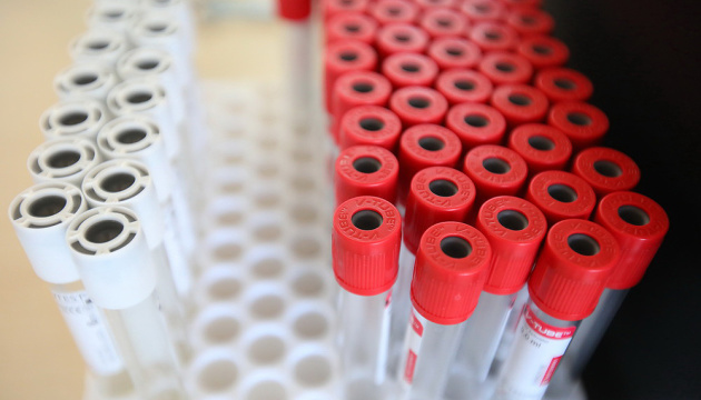 The world reaches 142 million cases of Corona virus