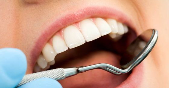 The Main Threats of Teeth Caries