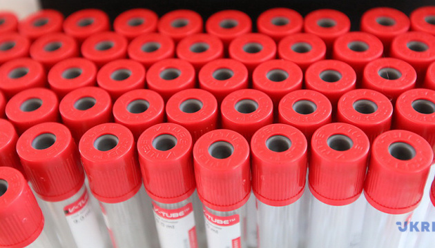 18,250 new cases of coronavirus were recorded in Ukraine
