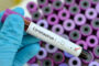 More than 311 million people worldwide have been diagnosed with coronavirus infection