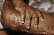 Monkeypox has been reported in 14 countries