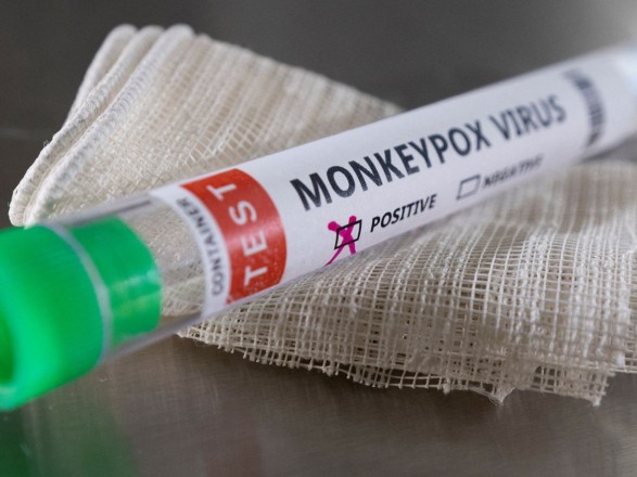 The first case of monkeypox has been confirmed in Venezuela