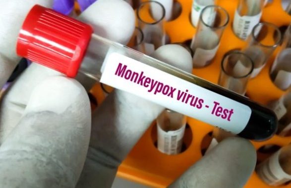 A second death from monkeypox was reported in Spain