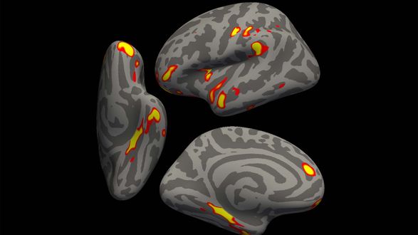 COVID increases risk of long-term brain injury - study