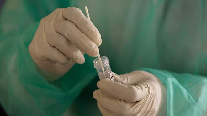سويسرا تخطط لاجراء اختبار فيروس كورونا لجميع سكانها
