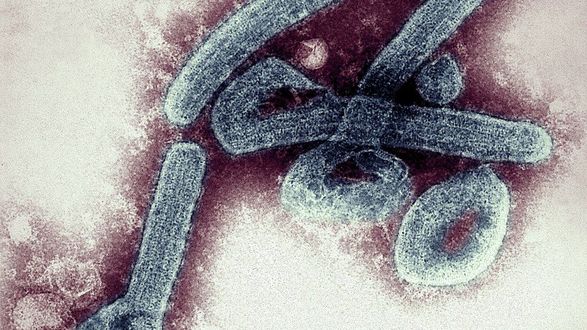 غانا تسجل أول حالة اصابة بفيروس ماربورغ