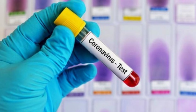 وزارة الصحة الأوكرانية تسجل أكثر من 16 ألف مصاب بفيروس كورونا خلال أسبوع